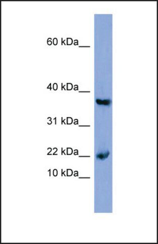 Anti-MB, (N-terminal) antibody produced in rabbit