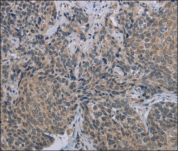 Anti-MARVELD1 antibody produced in rabbit