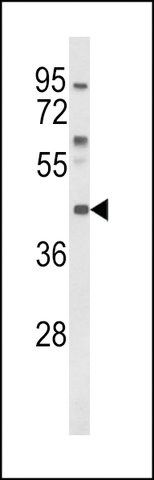 ANTI-MC3R (CENTER) antibody produced in rabbit
