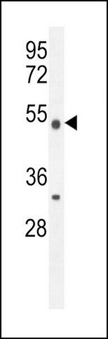 ANTI-METTL4 (C-TERM) antibody produced in rabbit