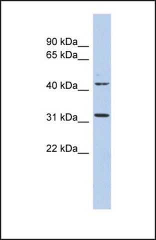 Anti-METTL6, (N-terminal) antibody produced in rabbit