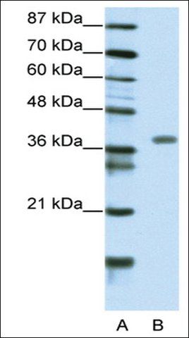 Anti-MEOX2 (AB1) antibody produced in rabbit