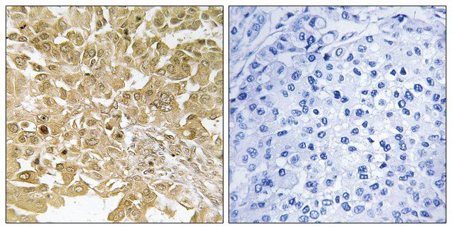 Anti-MEK1 antibody produced in rabbit