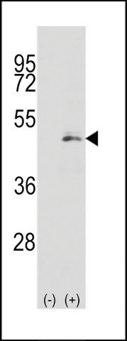 ANTI-MEK1 (MAP2K1) (S218) antibody produced in rabbit