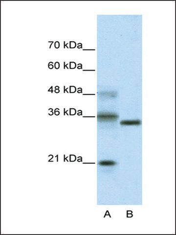 Anti-HES4 (AB2) antibody produced in rabbit