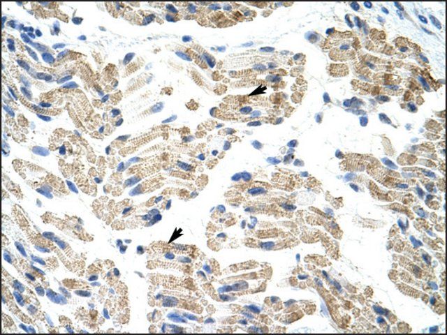 Anti-HNRPK (AB2) antibody produced in rabbit