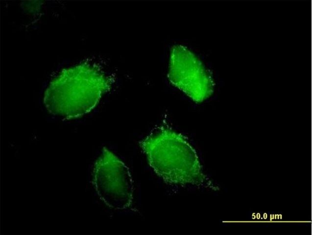Anti-HNRPD antibody produced in mouse