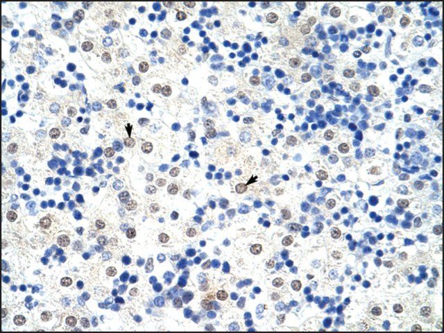 Anti-HNRPL antibody produced in rabbit