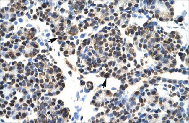 Anti-HOXB5 antibody produced in rabbit