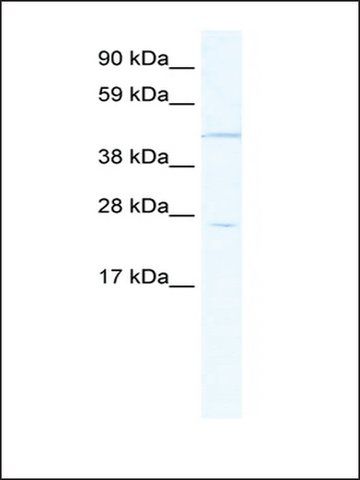 Anti-HOXB13 antibody produced in rabbit