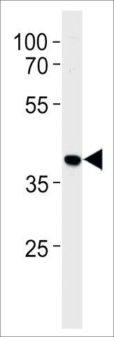 ANTI-HNRPAB(N-TERMINAL) antibody produced in rabbit