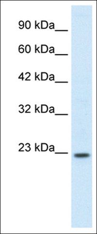 Anti-HOXB6 antibody produced in rabbit