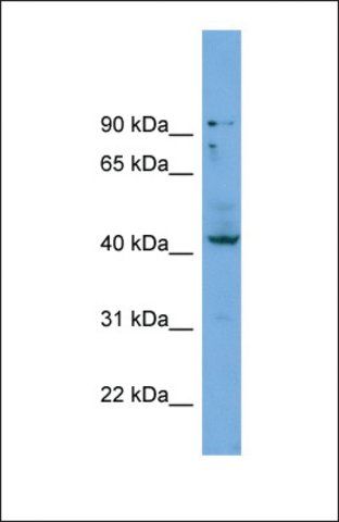 Anti-HOXB3 antibody produced in rabbit