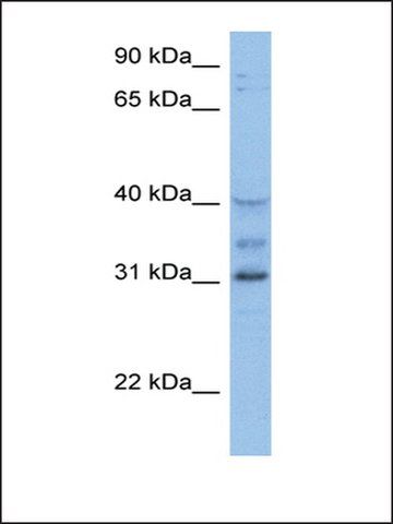 Anti-HOXD1 (AB2) antibody produced in rabbit
