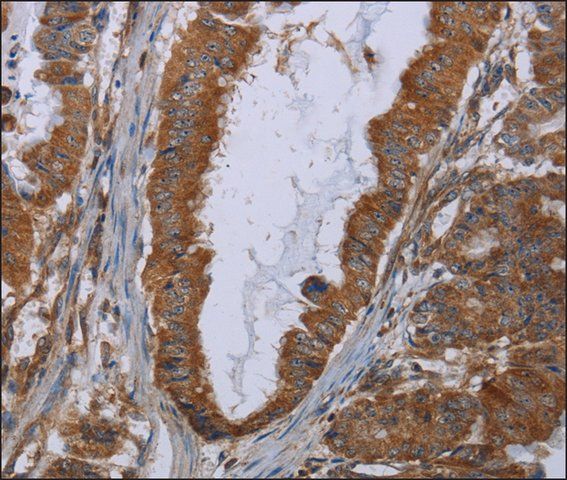Anti-INSIG2 antibody produced in rabbit