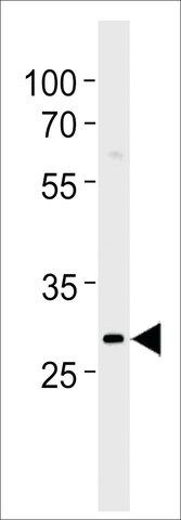 ANTI-IPF (S66) antibody produced in rabbit