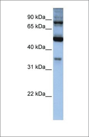 Anti-INPP5B antibody produced in rabbit