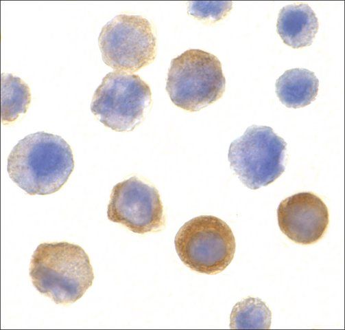 Anti-IRAK antibody produced in rabbit