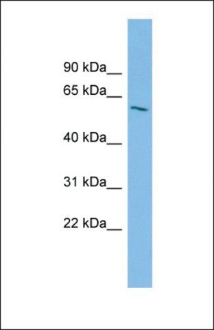 Anti-IPPK antibody produced in rabbit