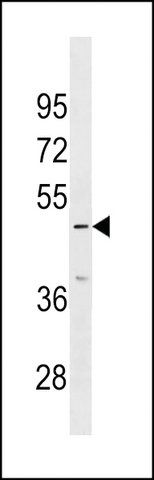 ANTI-IP6K3(N-TERMINAL) antibody produced in rabbit