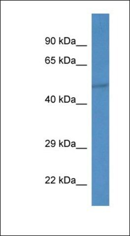 Anti-IPPK antibody produced in rabbit