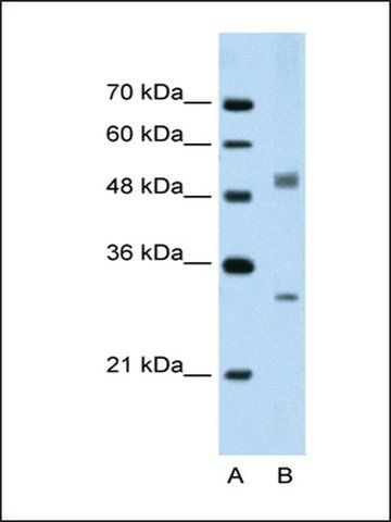 Anti-IRF6 antibody produced in rabbit
