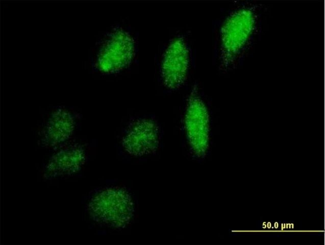 Anti-IPPK antibody produced in mouse