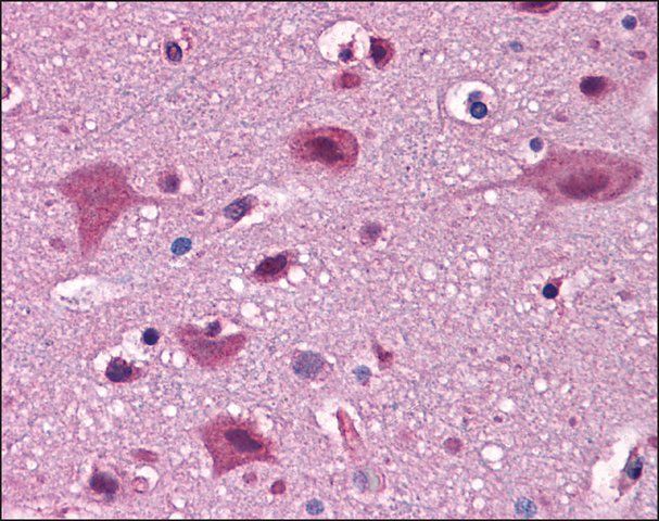 Anti-IRGC antibody produced in rabbit