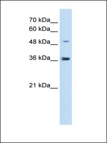 Anti-IRX1 (AB2) antibody produced in rabbit