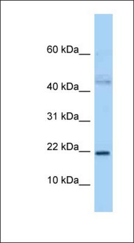Anti-JDP2 antibody produced in rabbit