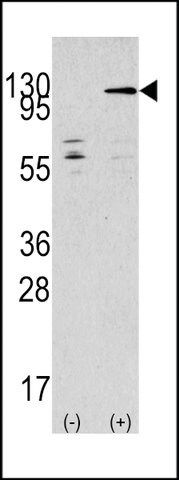ANTI-JIK (TAOK3)(C-TERMINAL) antibody produced in rabbit