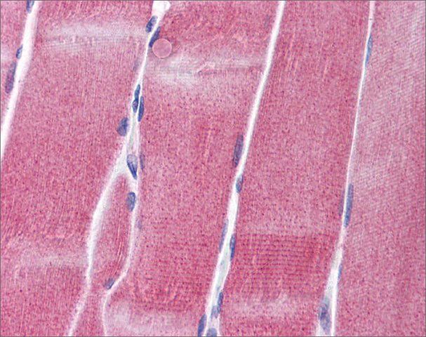 Anti-KCNC4 antibody produced in rabbit