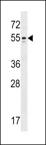 ANTI-KCNA6 (N-TERM) antibody produced in rabbit