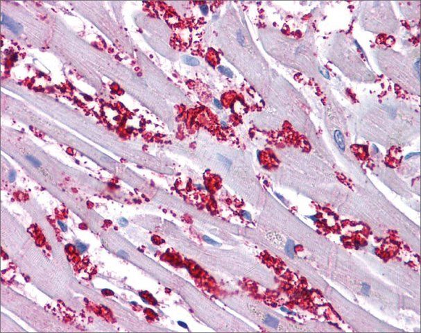 Anti-KCNA10 antibody produced in rabbit
