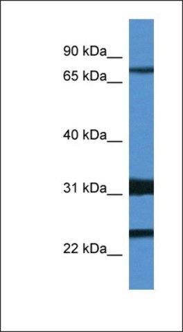 Anti-KCND1 antibody produced in rabbit