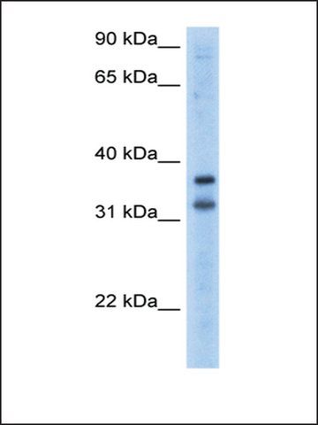 Anti-KCNRG (AB2) antibody produced in rabbit