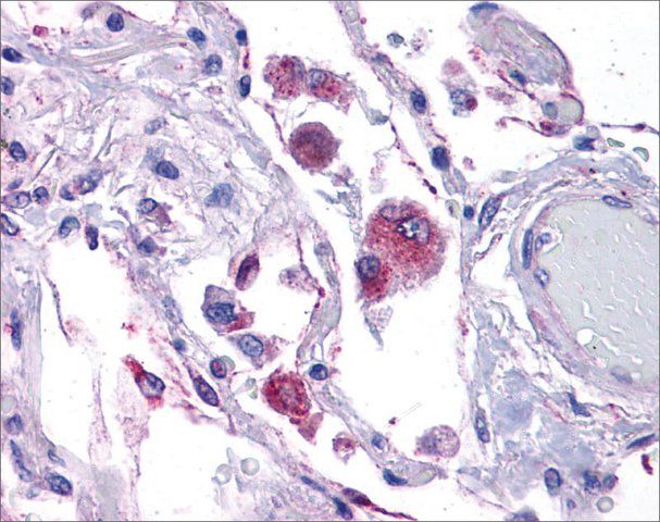 Anti-KITLG antibody produced in rabbit
