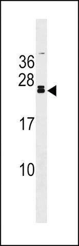 ANTI-FGF20(C-TERMINAL) antibody produced in rabbit