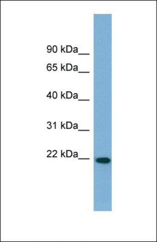 Anti-FNDC4 antibody produced in rabbit