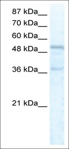 Anti-FOXC1 antibody produced in rabbit
