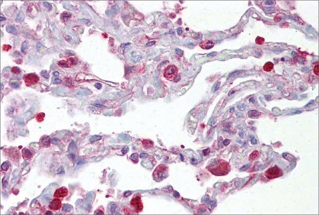 Anti-FOSL1 antibody produced in rabbit