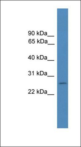 Anti-FOLR4 antibody produced in rabbit