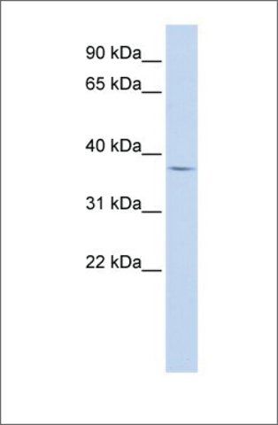 Anti-FOXB1 antibody produced in rabbit