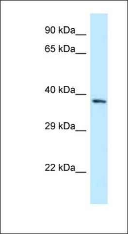 Anti-FPGT antibody produced in rabbit