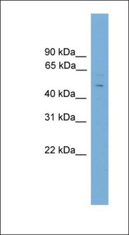 Anti-FOXC2 antibody produced in rabbit