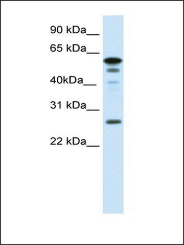 Anti-FOXD1 (AB1) antibody produced in rabbit