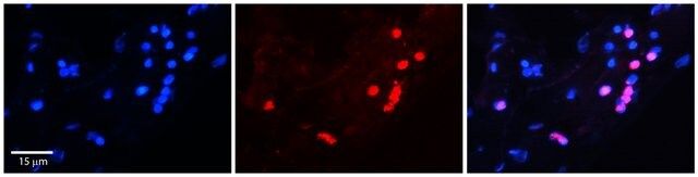 Anti-FOXA1 antibody produced in rabbit