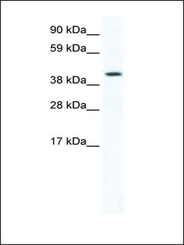 Anti-FOXF1A antibody produced in rabbit