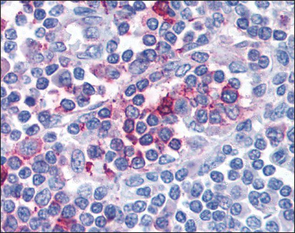 Anti-FPR1 antibody produced in rabbit