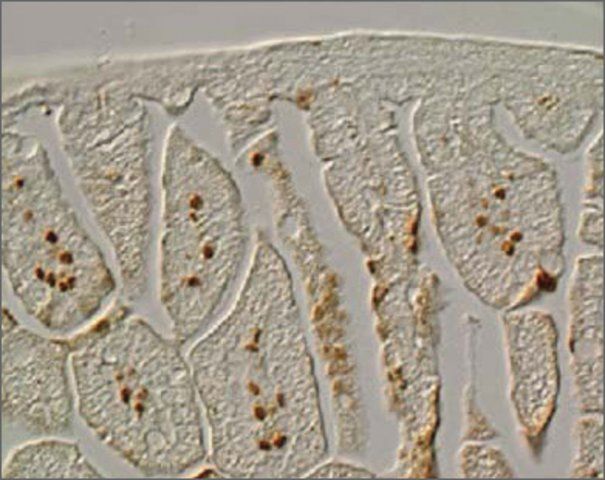 Anti-FOXF1A antibody produced in rabbit